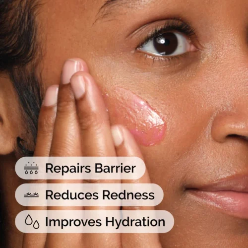 The Ordinary Soothing & Barrier Support Serum - Image 2