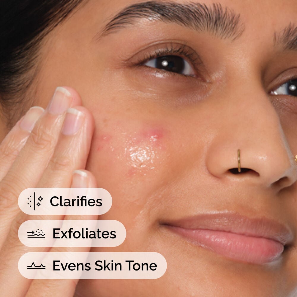 The Ordinary Salicylic Acid 2% Anhydrous Solution-ის გამოყენება