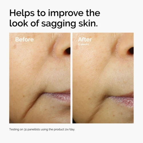 Visible firmness results of The Ordinary Caffeine + Escin Face Serum