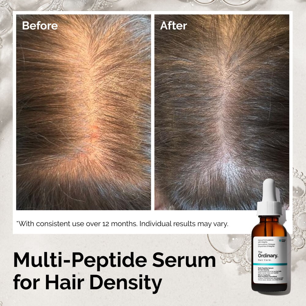 Результат до и после применения The Ordinary Multi-Peptide Serum for Hair Density